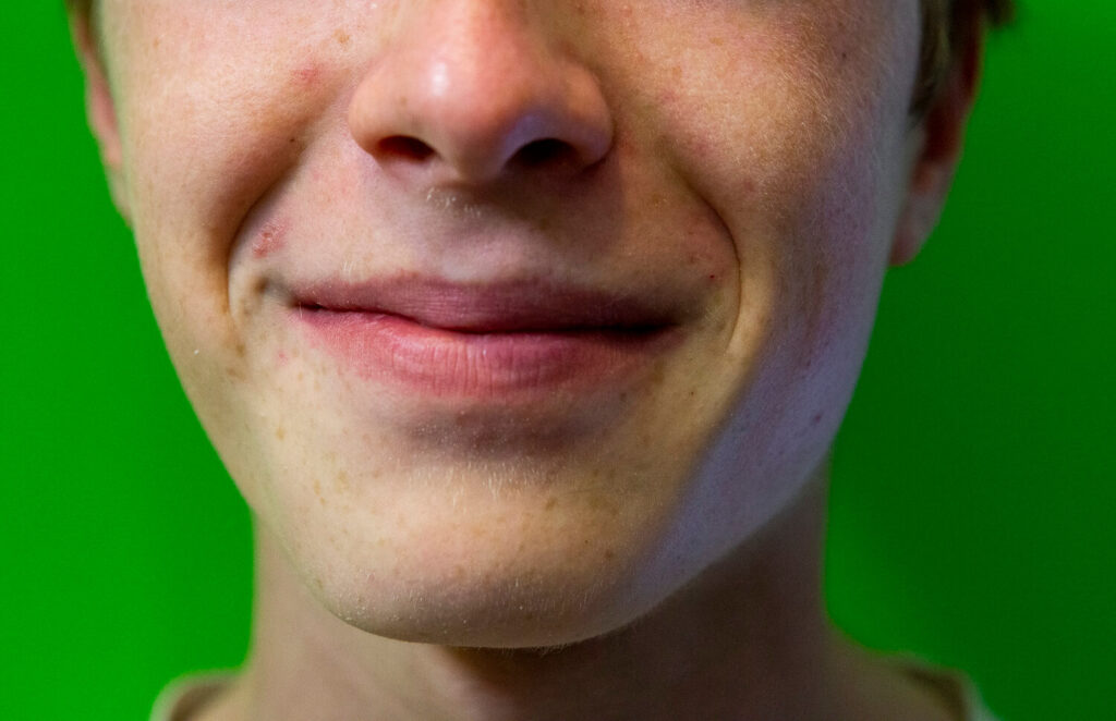 sorriso dopo la prima barba